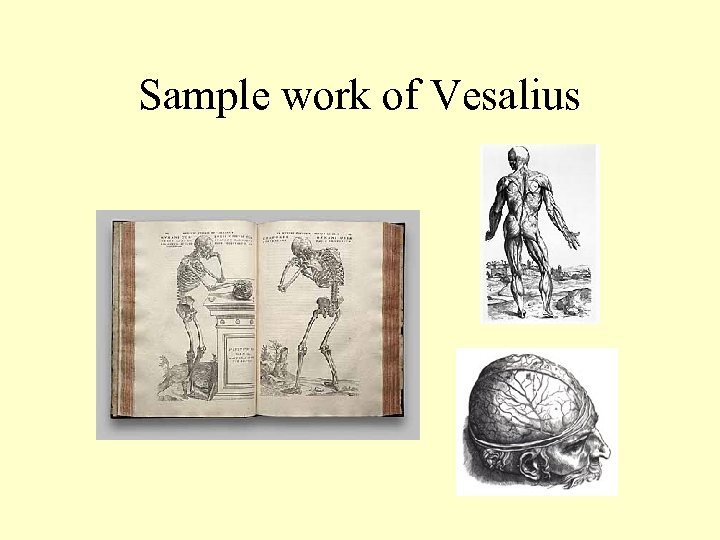 Sample work of Vesalius 