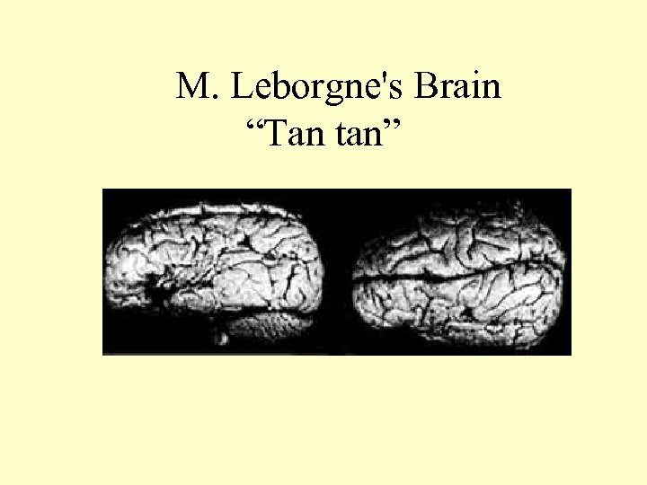  M. Leborgne's Brain “Tan tan” 