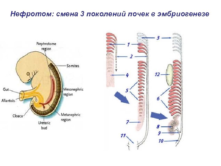 Нефротом: смена 3 поколений почек в эмбриогенезе 