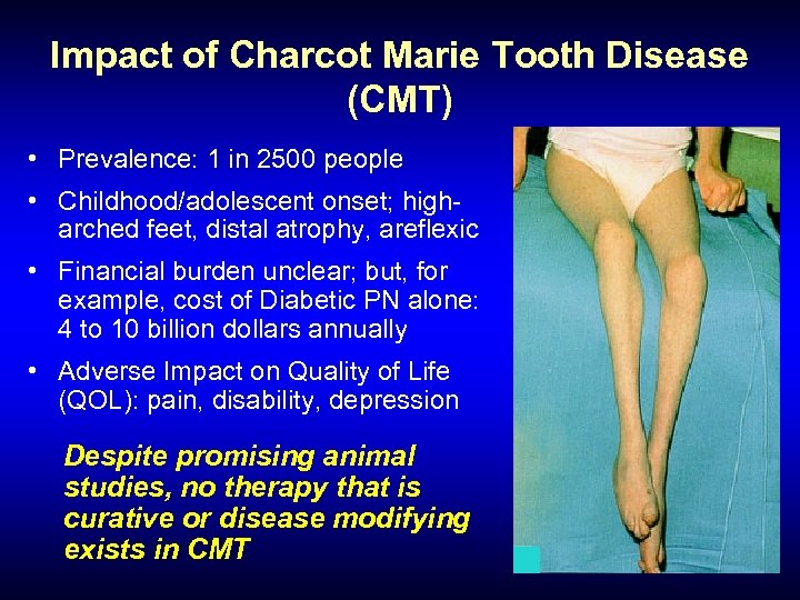 Impact of Charcot Marie Tooth Disease (CMT) • Prevalence: 1 in 2500 people •