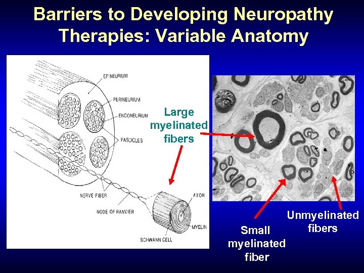 Barriers to Developing Neuropathy Therapies: Variable Anatomy Large myelinated fibers Small myelinated fiber Unmyelinated