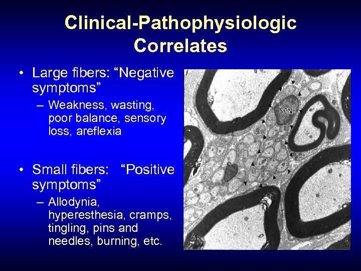 Clinical-Pathophysiologic Correlates • Large fibers: “Negative symptoms” – Weakness, wasting, poor balance, sensory loss,