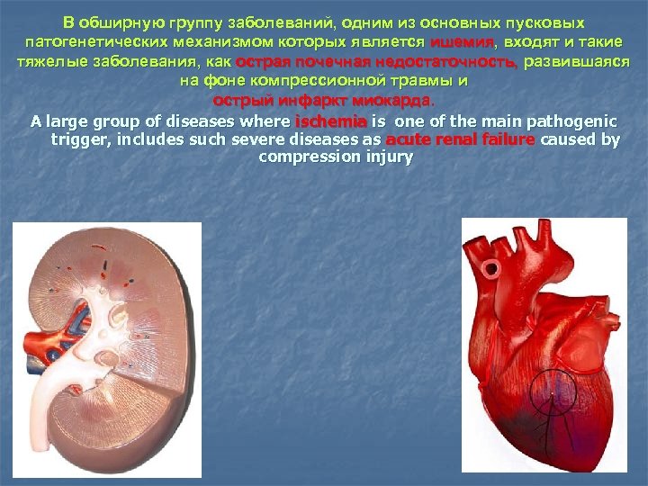 В обширную группу заболеваний, одним из основных пусковых патогенетических механизмом которых является ишемия, входят