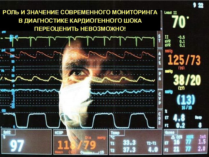 РОЛЬ И ЗНАЧЕНИЕ СОВРЕМЕННОГО МОНИТОРИНГА В ДИАГНОСТИКЕ КАРДИОГЕННОГО ШОКА ПЕРЕОЦЕНИТЬ НЕВОЗМОЖНО! 