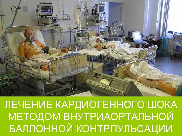 ЛЕЧЕНИЕ КАРДИОГЕННОГО ШОКА МЕТОДОМ ВНУТРИАОРТАЛЬНОЙ БАЛЛОННОЙ КОНТРПУЛЬСАЦИИ 