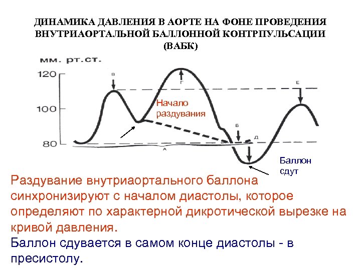 Давление в аорте. Внутриаортальная баллонная контрпульсация. Внутриаортальная баллонная контрпульсация (ВАБК). Баллонная контрпульсация аорты. Показания для проведения внутриаортальной баллонной контрпульсации.