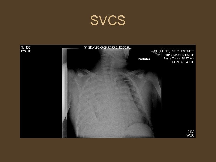 SVCS 