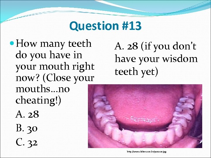 Question #13 How many teeth do you have in your mouth right now? (Close