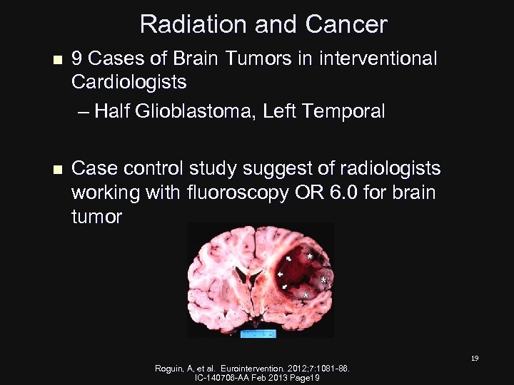 Radiation and Cancer n 9 Cases of Brain Tumors in interventional Cardiologists – Half