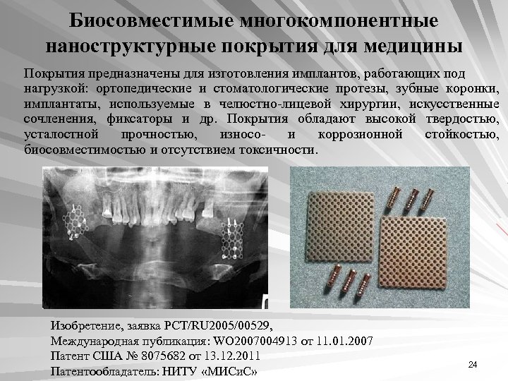 Биосовместимые многокомпонентные наноструктурные покрытия для медицины Покрытия предназначены для изготовления имплантов, работающих под нагрузкой: