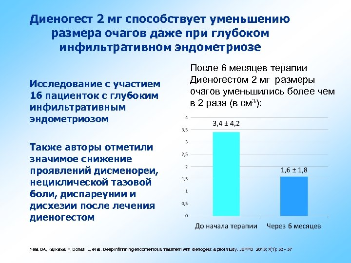 Диеногест 2 мг способствует уменьшению размера очагов даже при глубоком инфильтративном эндометриозе Исследование с