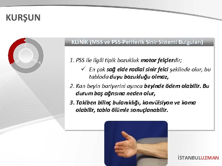 KLİNİK (MSS ve PSS-Periferik Sinir Sistemi Bulguları) 1. PSS ile ilgili tipik bozukluk motor