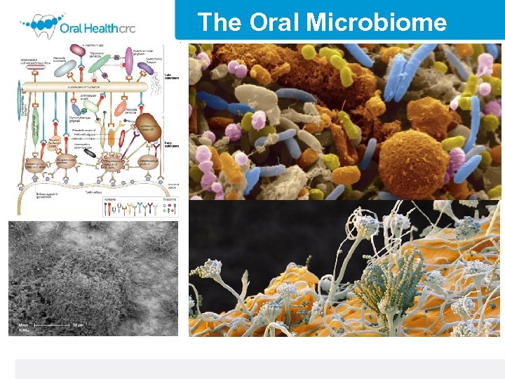 The Oral Microbiome 