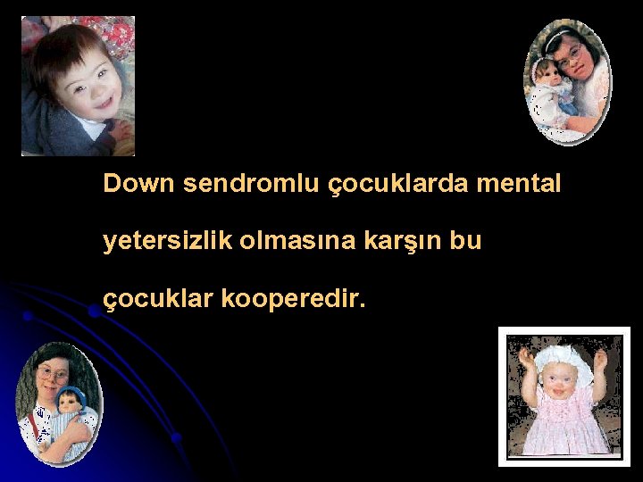 Down sendromlu çocuklarda mental yetersizlik olmasına karşın bu çocuklar kooperedir. 