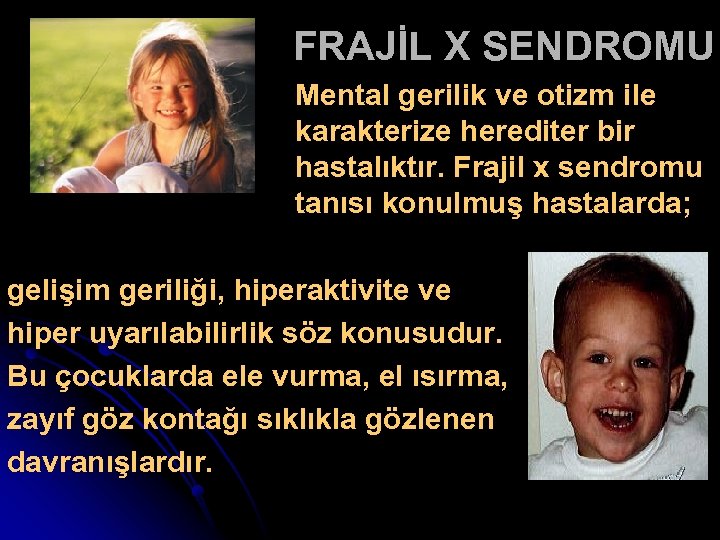 FRAJİL X SENDROMU Mental gerilik ve otizm ile karakterize herediter bir hastalıktır. Frajil x