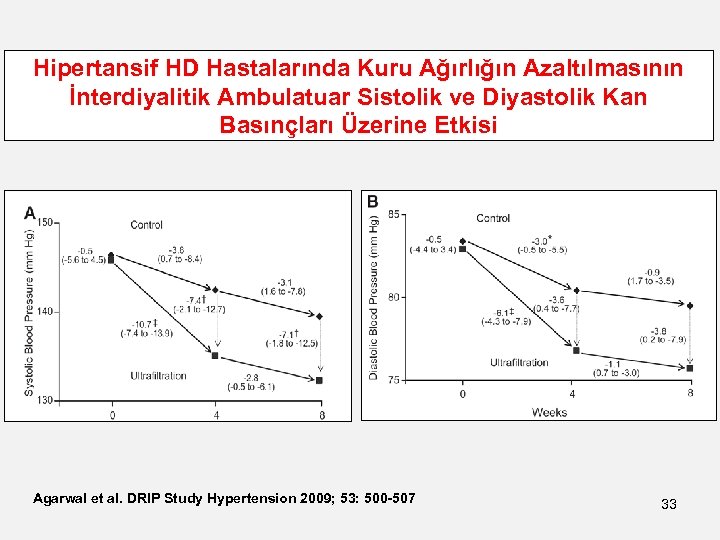 Hipertansif HD Hastalarında Kuru Ağırlığın Azaltılmasının İnterdiyalitik Ambulatuar Sistolik ve Diyastolik Kan Basınçları Üzerine