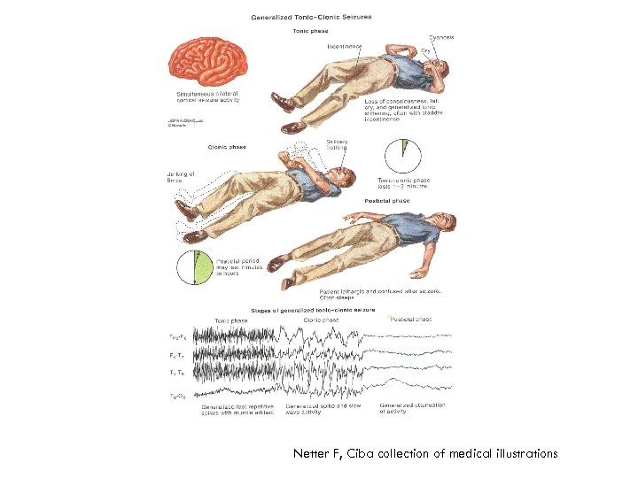 Netter F, Ciba collection of medical illustrations 