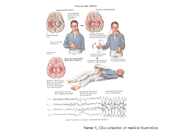 Netter F, Ciba collection of medical illustrations 