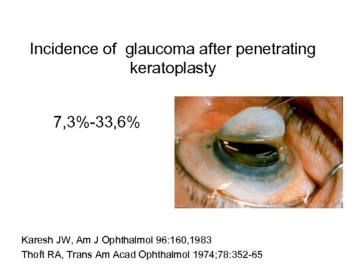 Incidence of glaucoma after penetrating keratoplasty 7, 3%-33, 6% Karesh JW, Am J Ophthalmol