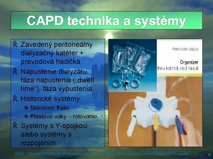 CAPD technika a systémy Ř Zavedený peritoneálny dialyzačný katéter + prevodová hadička. Ř Napustenie