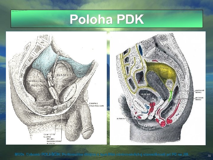 Poloha PDK MUDr. Ľubomír POLAŠČÍN: Peritoneálna dialýza a špecifiká ošetrovateľskej starostlivosti pri PD na