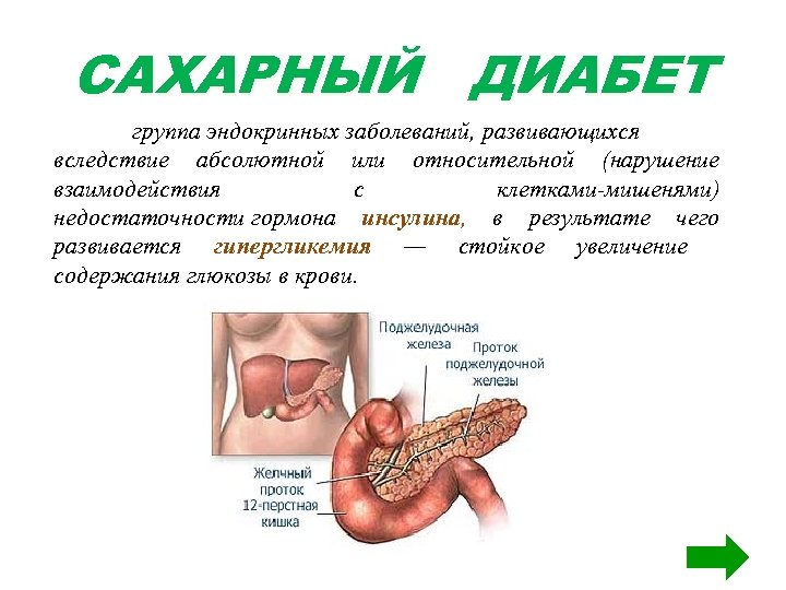 САХАРНЫЙ ДИАБЕТ группа эндокринных заболеваний, развивающихся вследствие абсолютной или относительной (нарушение взаимодействия с клетками-мишенями)