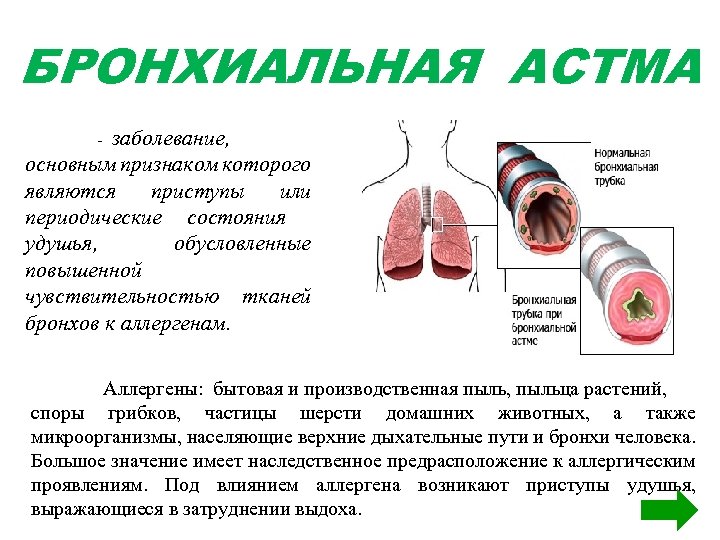 БРОНХИАЛЬНАЯ АСТМА заболевание, основным признаком которого являются приступы или периодические состояния удушья, обусловленные повышенной