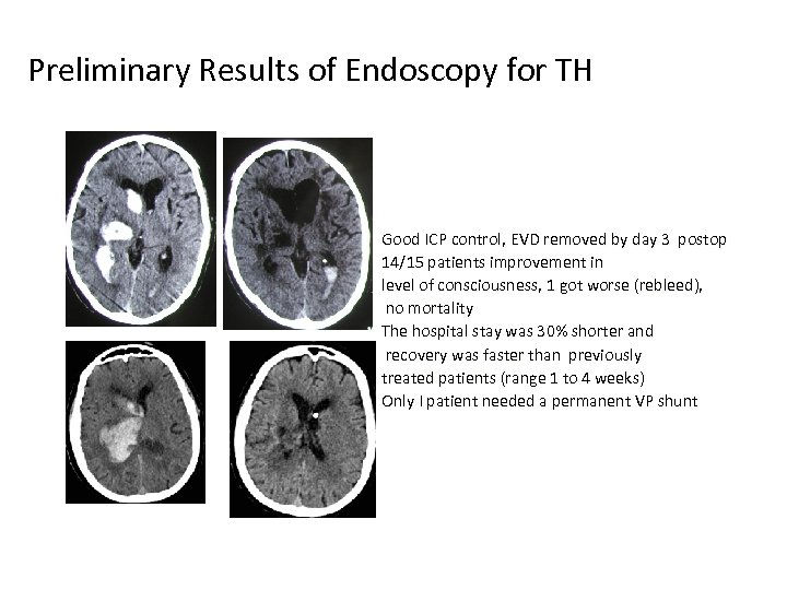 Preliminary Results of Endoscopy for TH Good ICP control, EVD removed by day 3