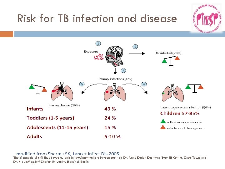 Risk for TB infection and disease The diagnosis of childhood tuberculosis in low/intermediate burden