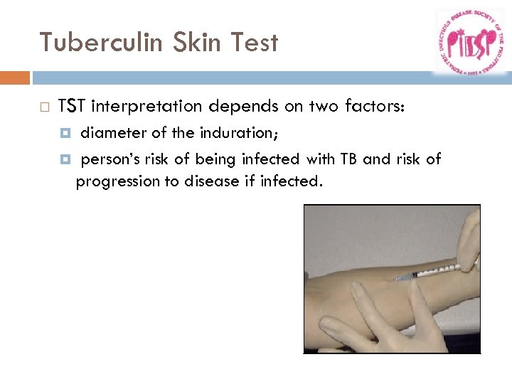 Tuberculin Skin Test TST interpretation depends on two factors: diameter of the induration; person’s
