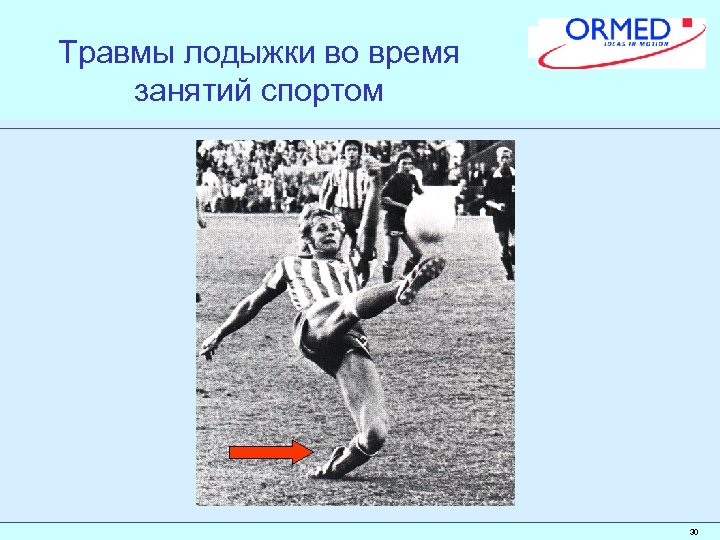 Травмы лодыжки во время занятий спортом 30 