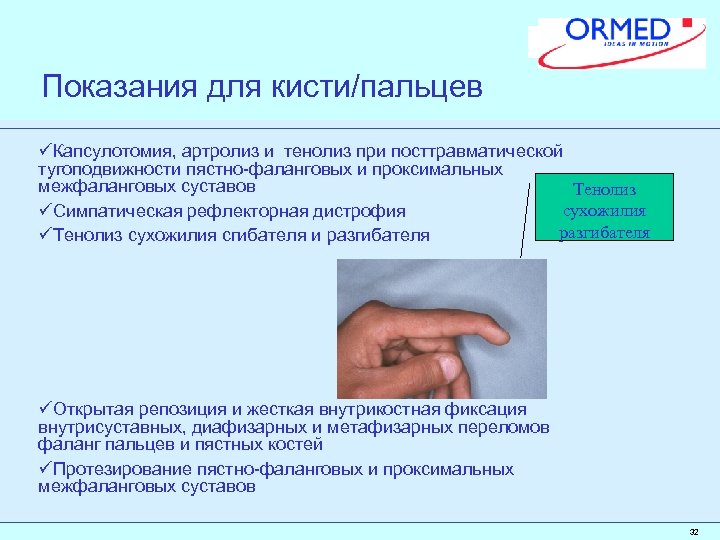Показания для кисти/пальцев üКапсулотомия, артролиз и тенолиз при посттравматической тугоподвижности пястно-фаланговых и проксимальных межфаланговых