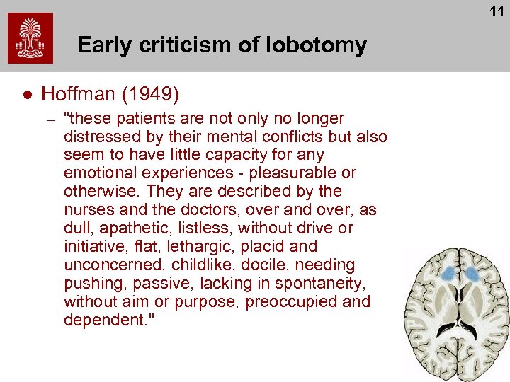 11 Early criticism of lobotomy l Hoffman (1949) – 