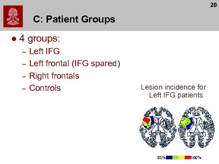 20 C: Patient Groups l 4 groups: – – Left IFG Left frontal (IFG