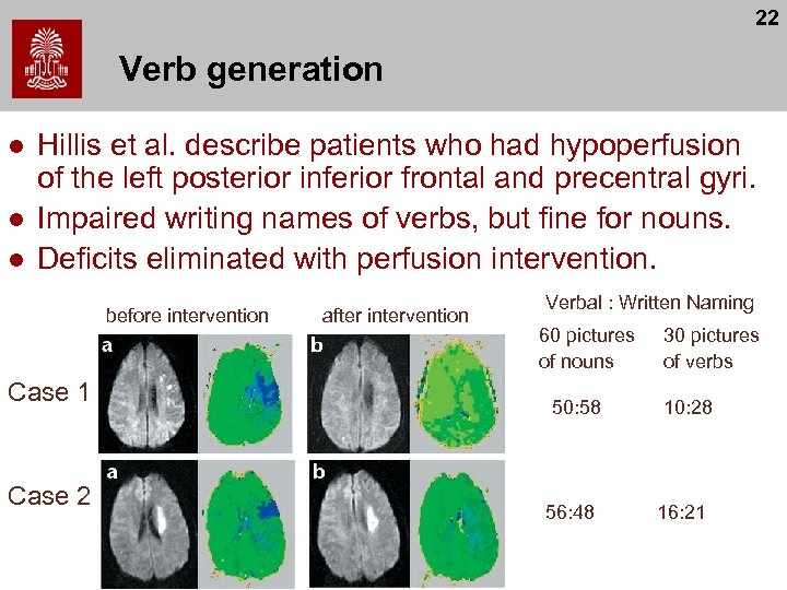 22 Verb generation l l l Hillis et al. describe patients who had hypoperfusion