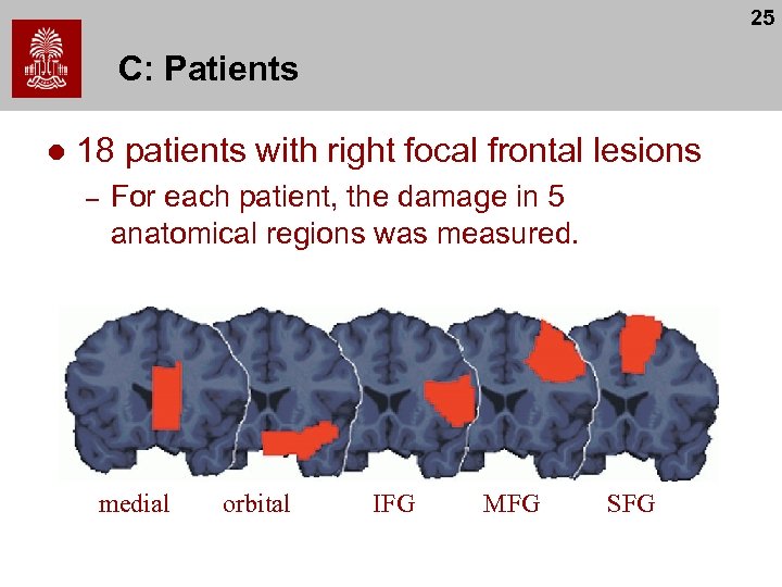 25 C: Patients l 18 patients with right focal frontal lesions – For each