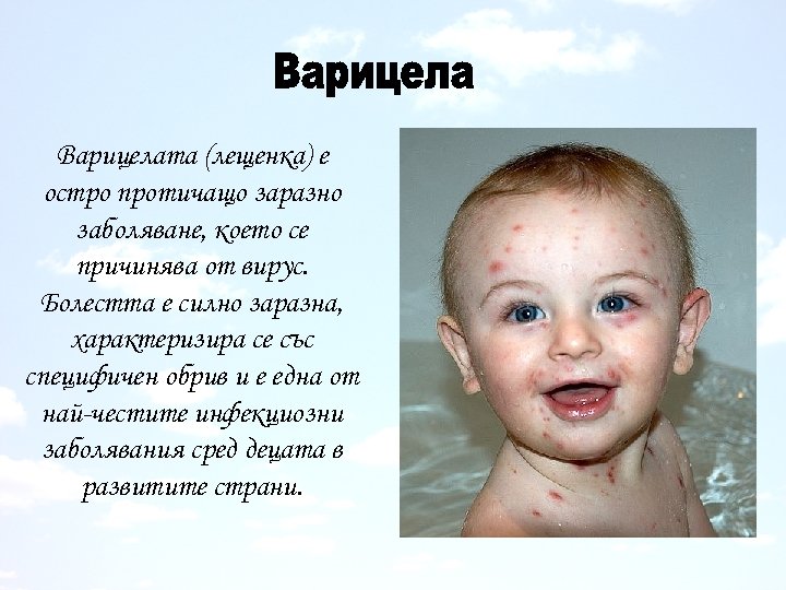 Варицелата (лещенка) е остро протичащо заразно заболяване, което се причинява от вирус. Болестта е