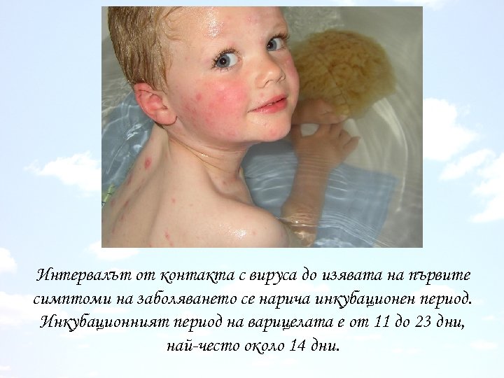 Интервалът от контакта с вируса до изявата на първите симптоми на заболяването се нарича