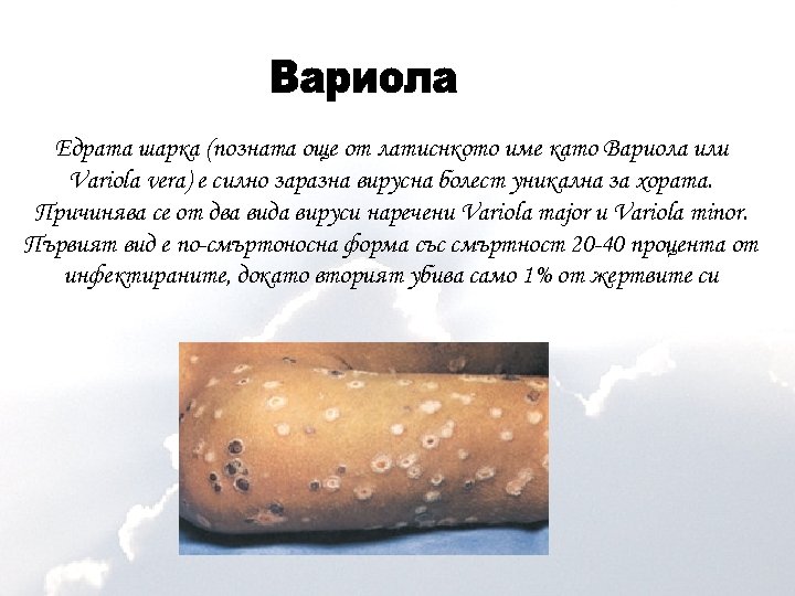 Едрата шарка (позната още от латиснкото име като Вариола или Variola vera) е силно