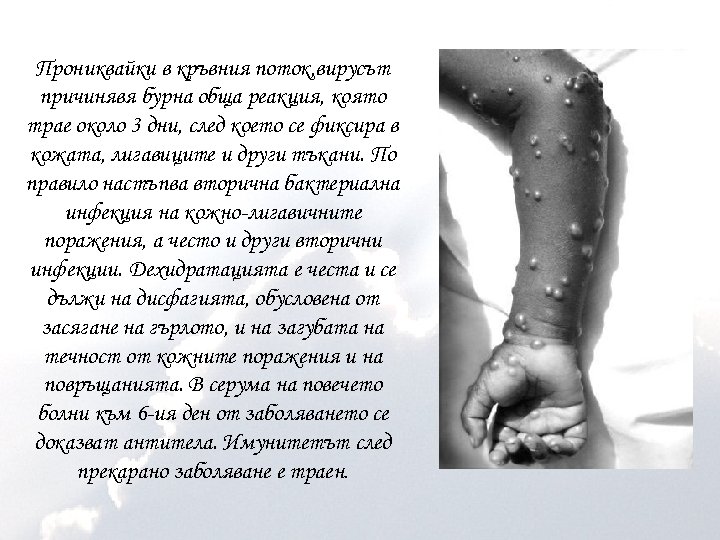 Прониквайки в кръвния поток, вирусът причинявя бурна обща реакция, която трае около 3 дни,