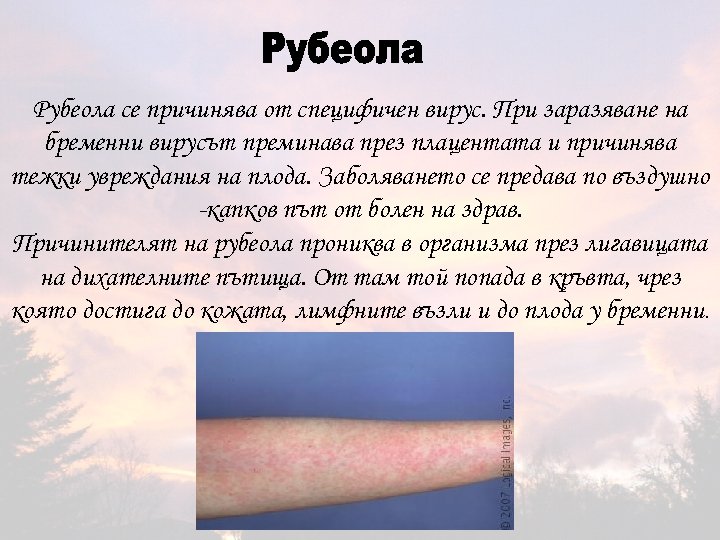 Рубеола се причинява от специфичен вирус. При заразяване на бременни вирусът преминава през плацентата