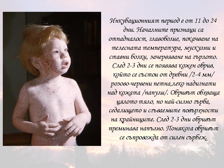 Инкубационният период е от 11 до 24 дни. Началните признаци са отпадналост, главоболие, покачване