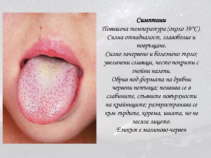 Симптоми Повишена температура (около 39°С). Силна отпадналост, главоболие и повръщане. Силно зачервено и болезнено