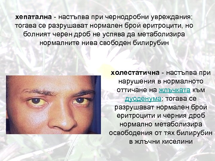 хепатална - настъпва при чернодробни увреждания; тогава се разрушават нормален брой еритроцити, но болният