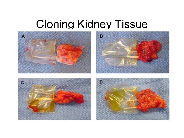 Cloning Kidney Tissue 