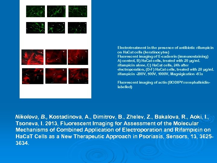 Electrotreatment in the presence of antibiotic rifampicin on Ha. Cat cells (keratinocytes) Fluorescent imaging