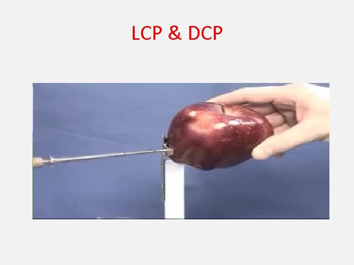 LCP & DCP 