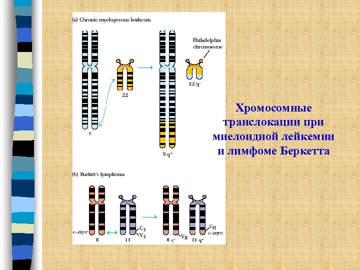 Хромосомные транслокации при миелоидной лейкемии и лимфоме Беркетта 