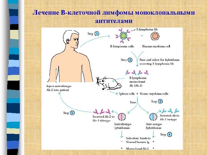 Лечение В-клеточной лимфомы моноклональными антителами 