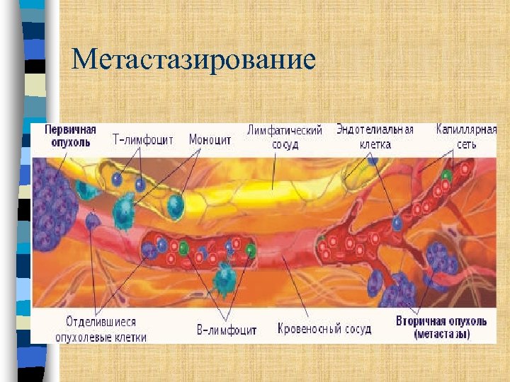 Метастазирование 